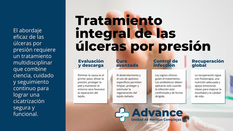 infografía tratamiento integral de úlceras por presión: evaluación y descarga, cura avanzada, control de infección y recuperación