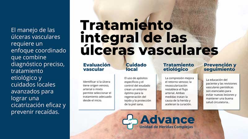 infografía tratamiento integral de úlceras vasculares: evaluación vascular, cuidado local, tratamiento etiológico y prevención