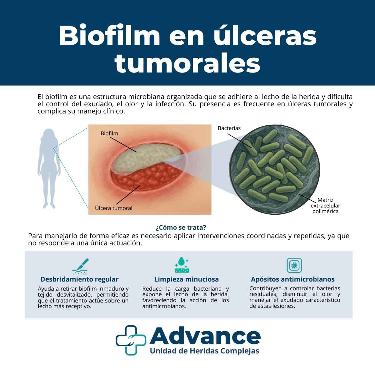 Infografía médica que explica qué es el biofilm en úlceras tumorales, cómo se forma y las medidas de tratamiento como desbridamiento, limpieza y apósitos antimicrobianos.