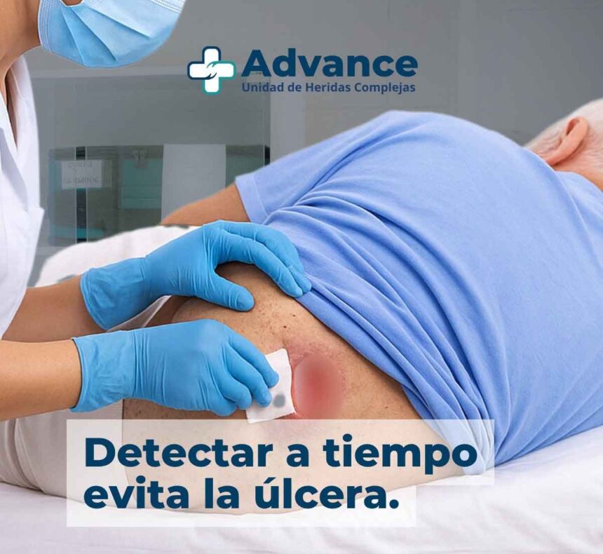 Detección temprana de úlceras por presión para prevenir heridas complejas en pacientes encamados.