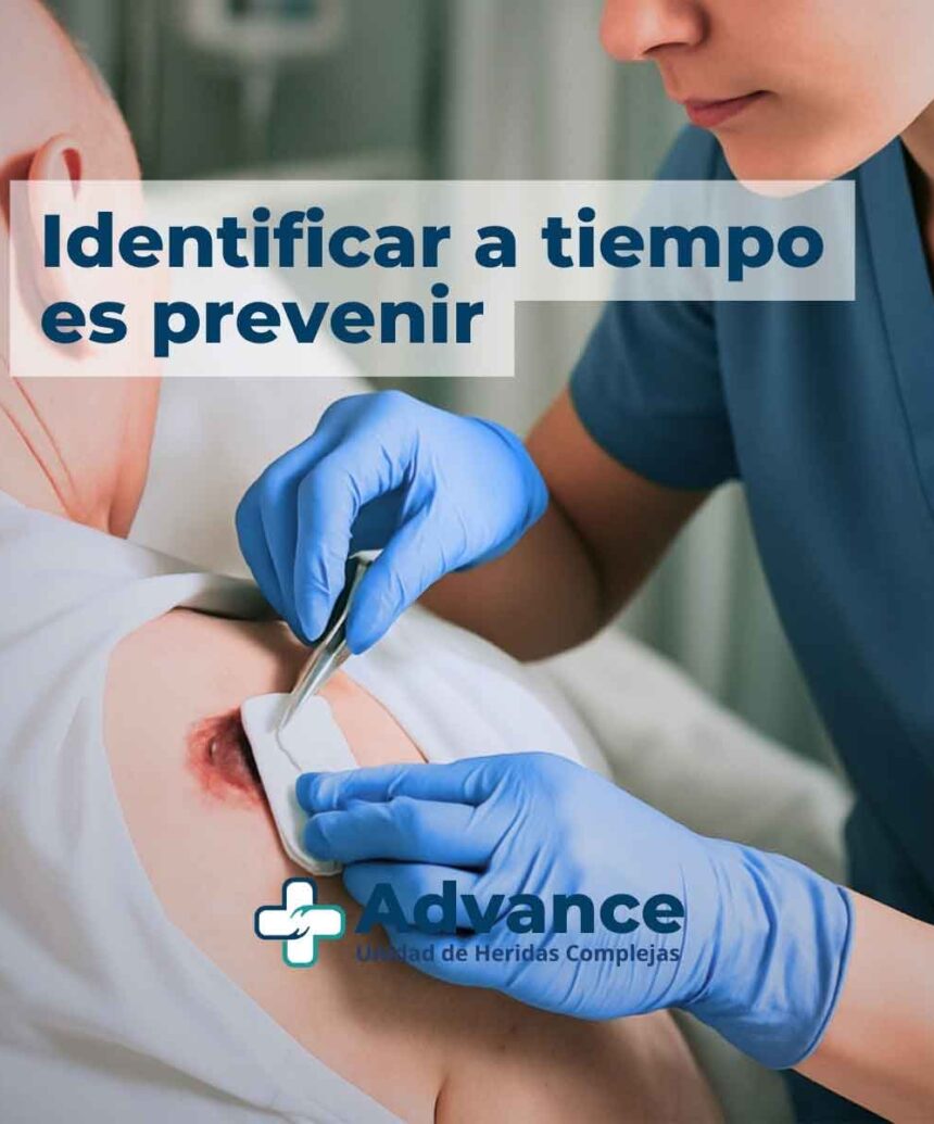Cura profesional de una escara en un paciente mayor encamado.