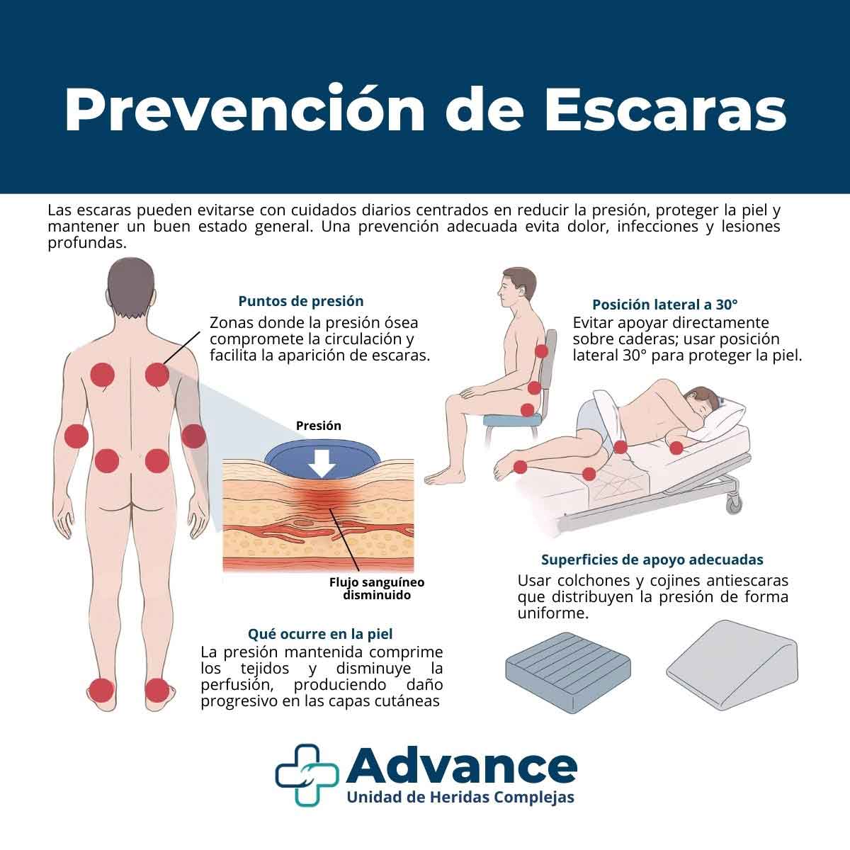 Infografía sobre prevención de escaras que muestra puntos de presión, cambios posturales y superficies de apoyo adecuadas elaborada por la Unidad de Heridas Complejas Advance.
