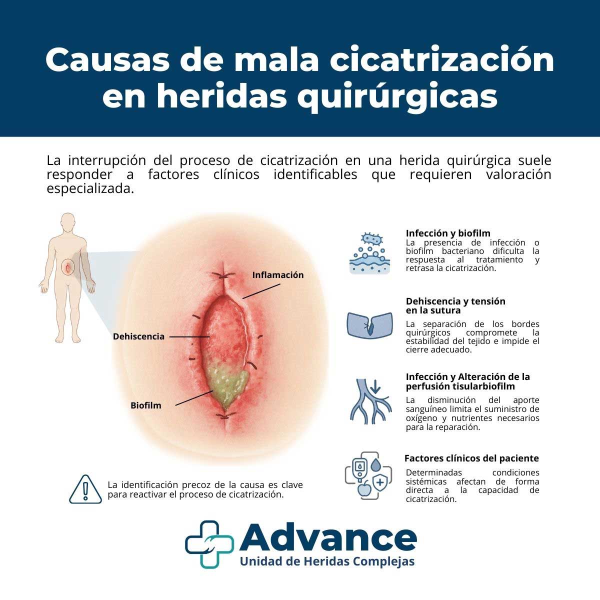 Infografía sobre las causas de mala cicatrización en heridas quirúrgicas como infección, biofilm, dehiscencia y alteración de la perfusión