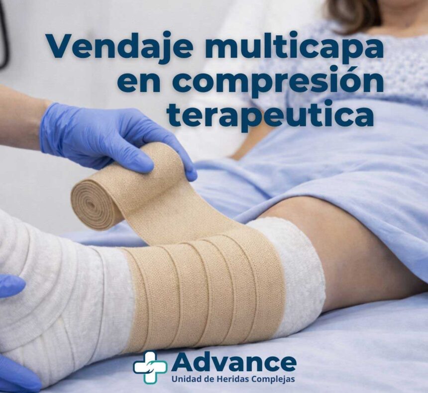 Aplicación de vendaje multicapa en compresión terapéutica para el tratamiento de heridas de origen venoso.