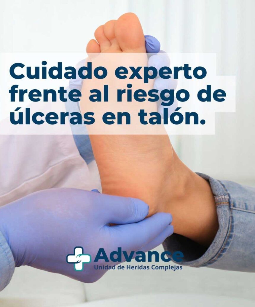 Evaluación clínica especializada del talón para detectar riesgo de úlceras por presión.