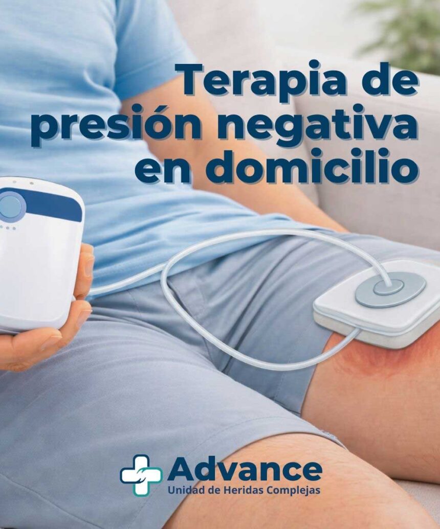 Uso domiciliario de la terapia de presión negativa con dispositivos portátiles para heridas seleccionadas.