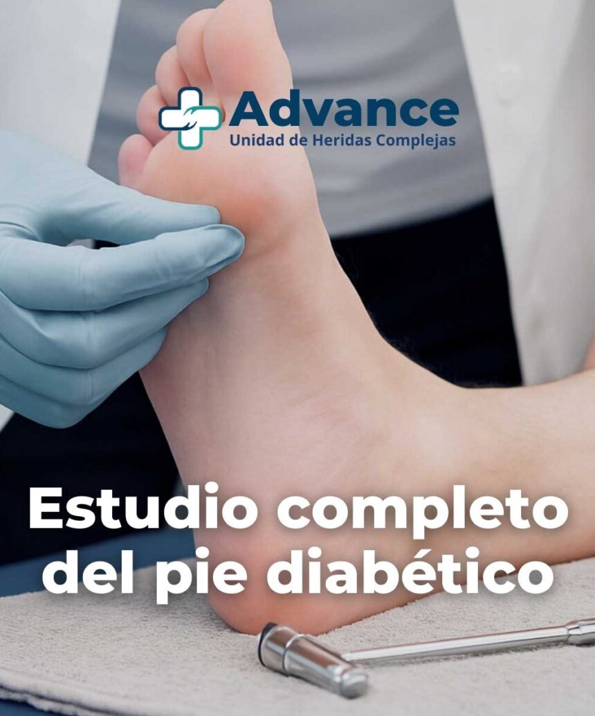 El estudio del pie diabético permite evaluar si una úlcera puede tratarse con seguridad y qué factores pueden dificultar su cicatrización.