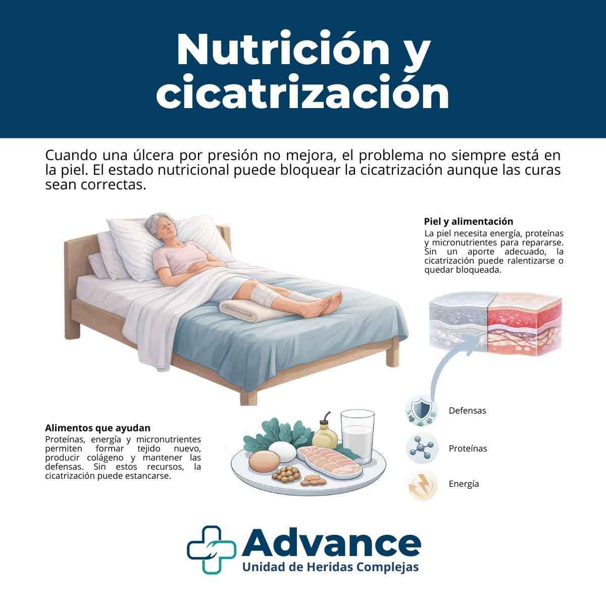 Ilustración de una persona mayor en cama con úlcera por presión vendada y representación de piel en regeneración relacionada con el estado nutricional.