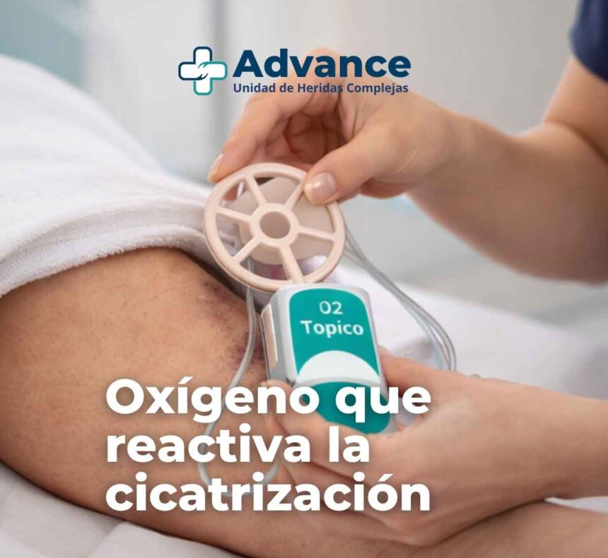 Aplicación de oxígeno tópico para reactivar la cicatrización en heridas crónicas.