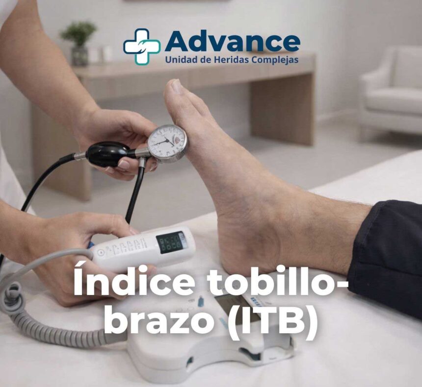 Qué es el índice tobillo-brazo, cómo se realiza y qué significan sus valores antes de aplicar compresión en úlceras de la pierna.