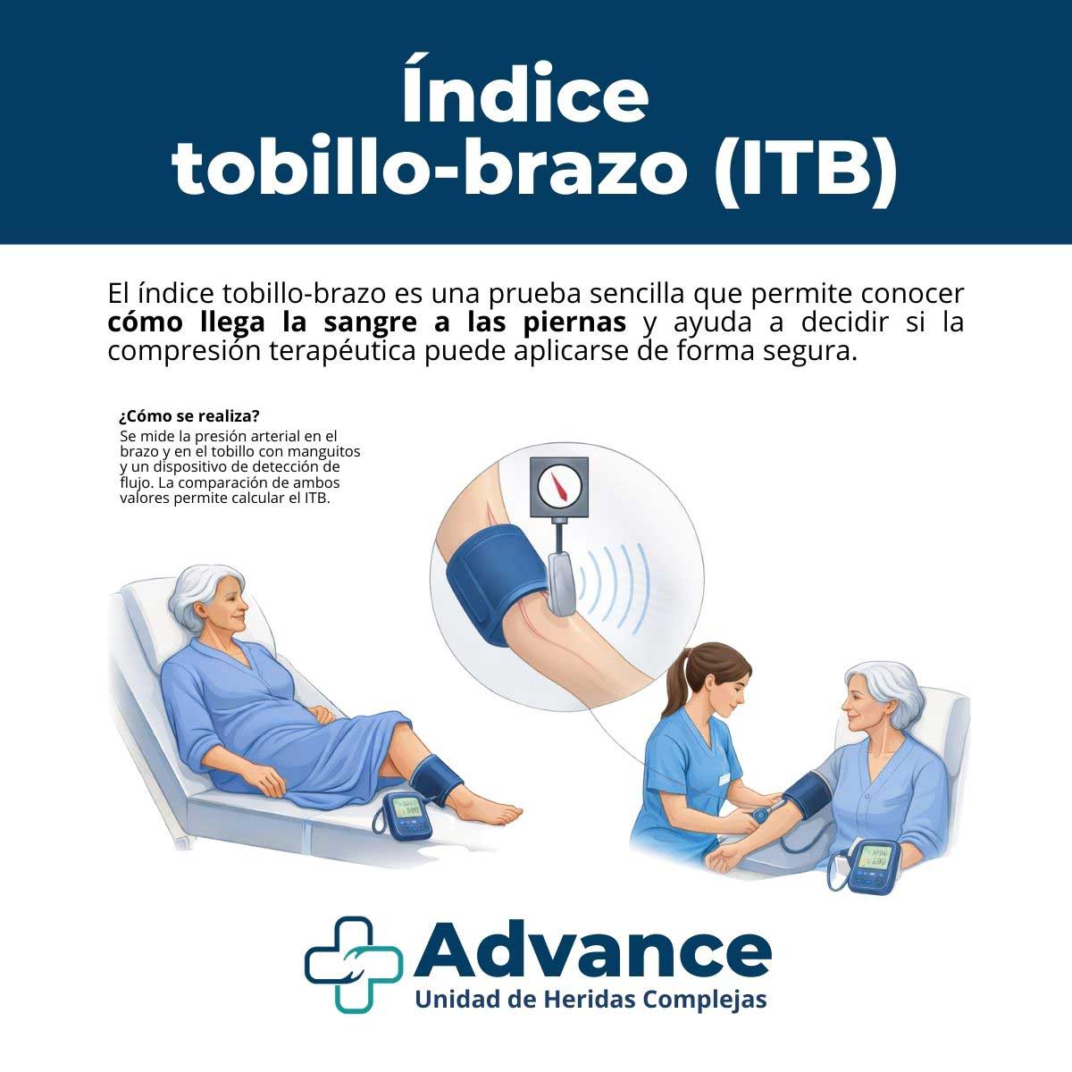 Infografía explicativa sobre el índice tobillo-brazo, cómo se mide y para qué sirve en la valoración de úlceras en la pierna.