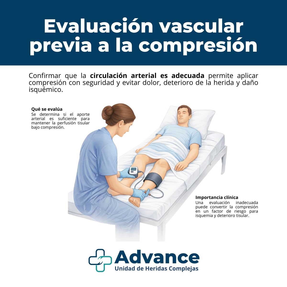 Infografía médica sobre evaluación vascular previa a la compresión terapéutica en piernas.