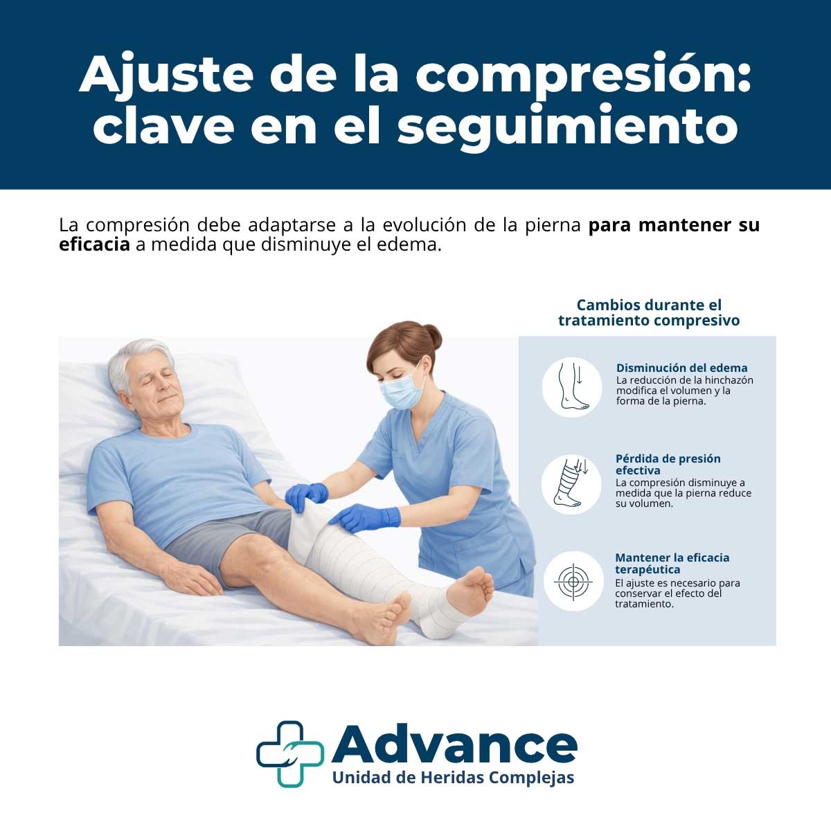 Infografía médica que explica cómo adaptar la compresión a medida que disminuye el edema en la pierna