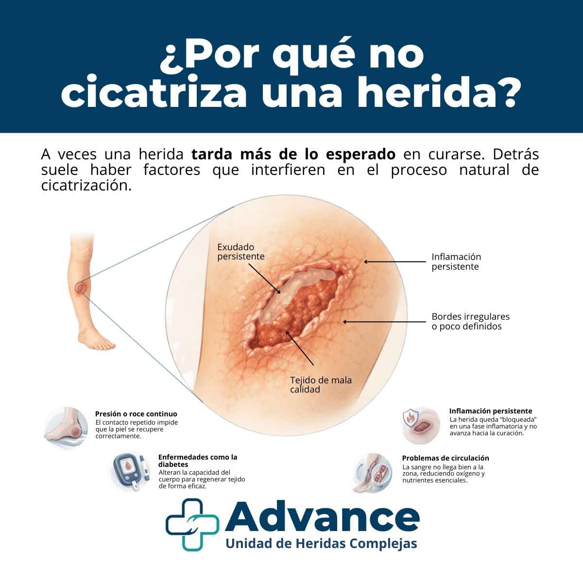 Infografía médica que explica las causas por las que una herida no cicatriza, incluyendo inflamación, mala circulación, presión y diabetes