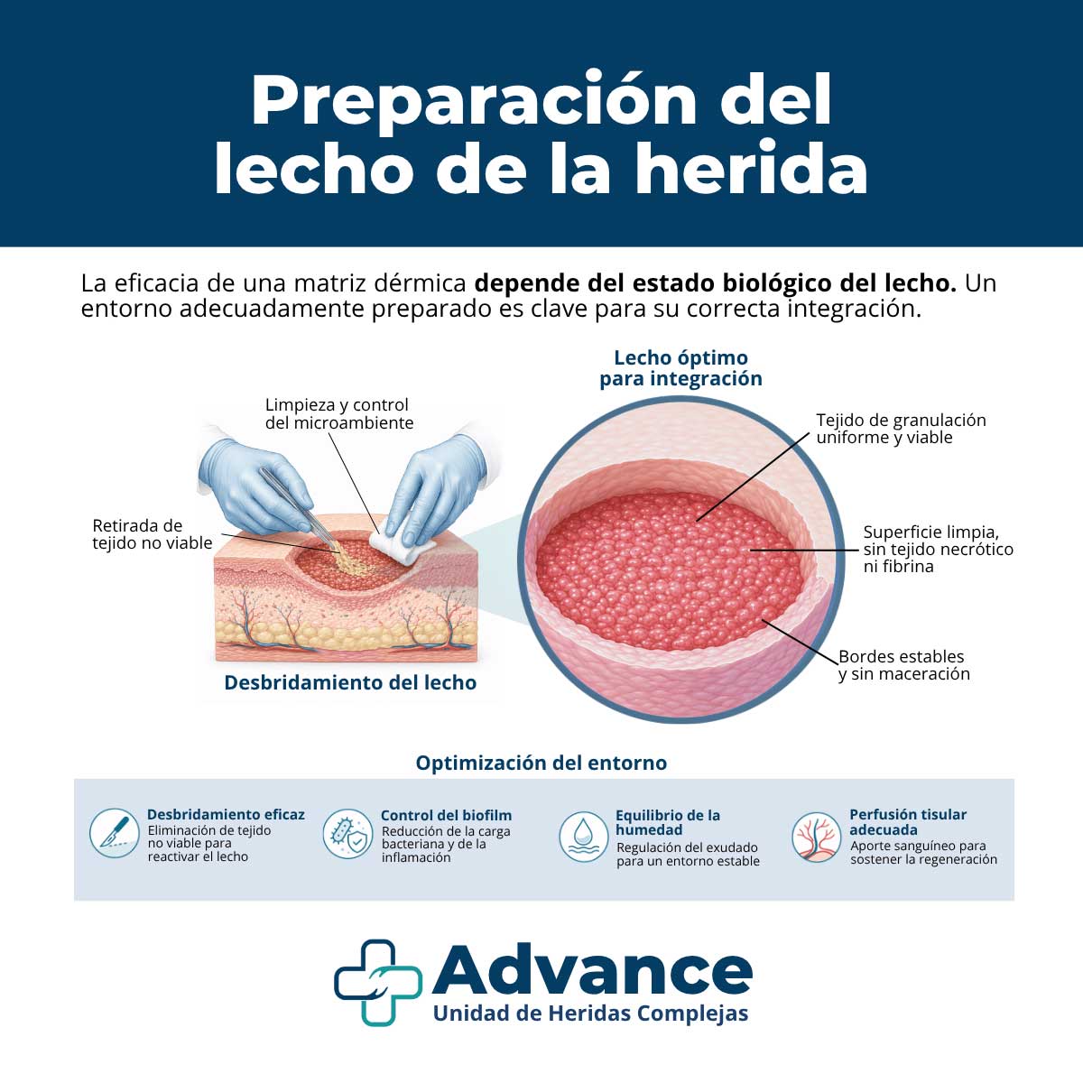 Infografía sobre la preparación del lecho de la herida con desbridamiento, control del biofilm y optimización del entorno