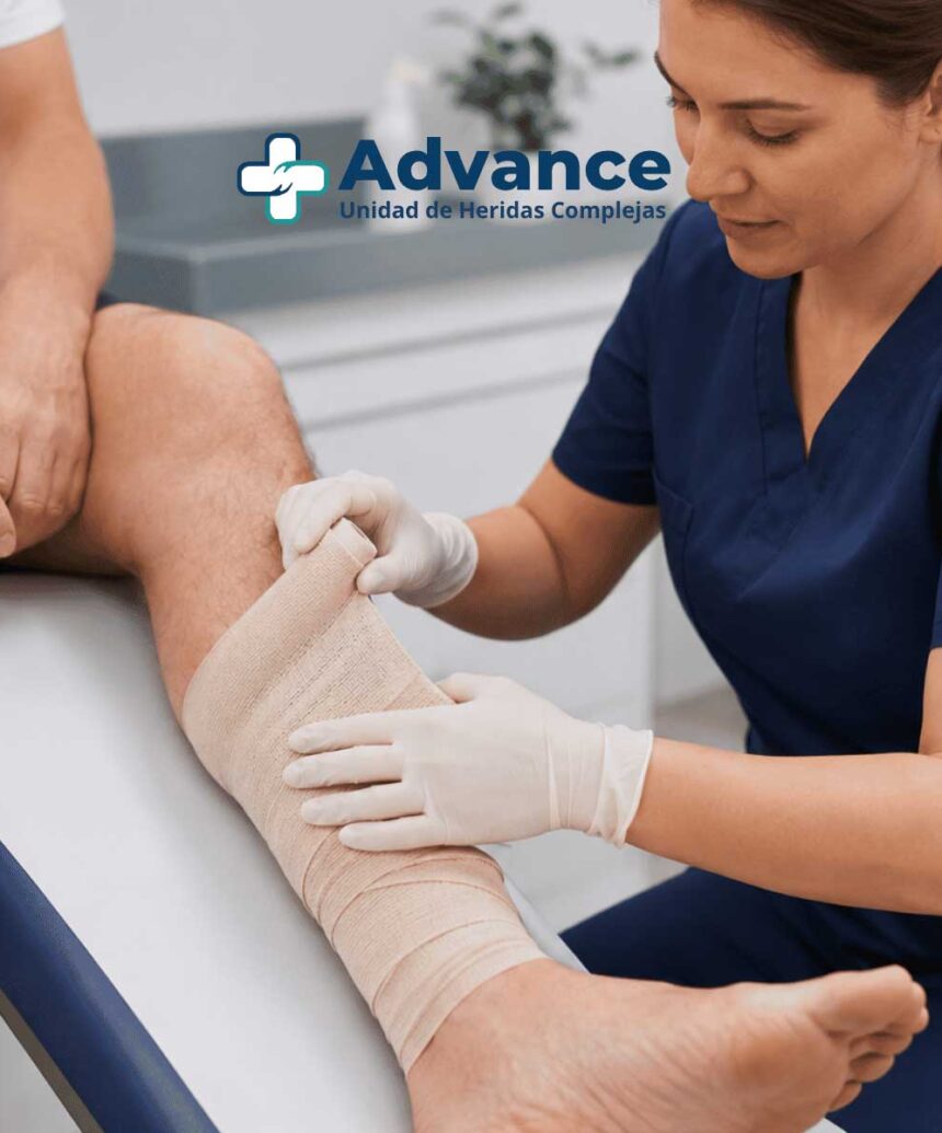 La compresión terapéutica debe aplicarse de forma controlada y adaptada a cada paciente para ayudar a reducir el edema y favorecer la cicatrización.