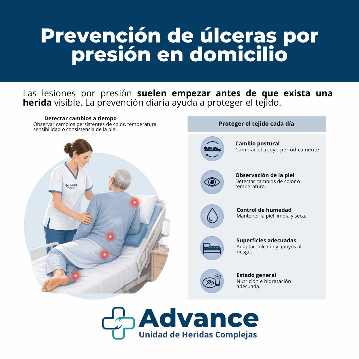 Infografía sobre prevención de úlceras por presión con medidas de cuidado domiciliario y detección precoz de cambios en la piel.