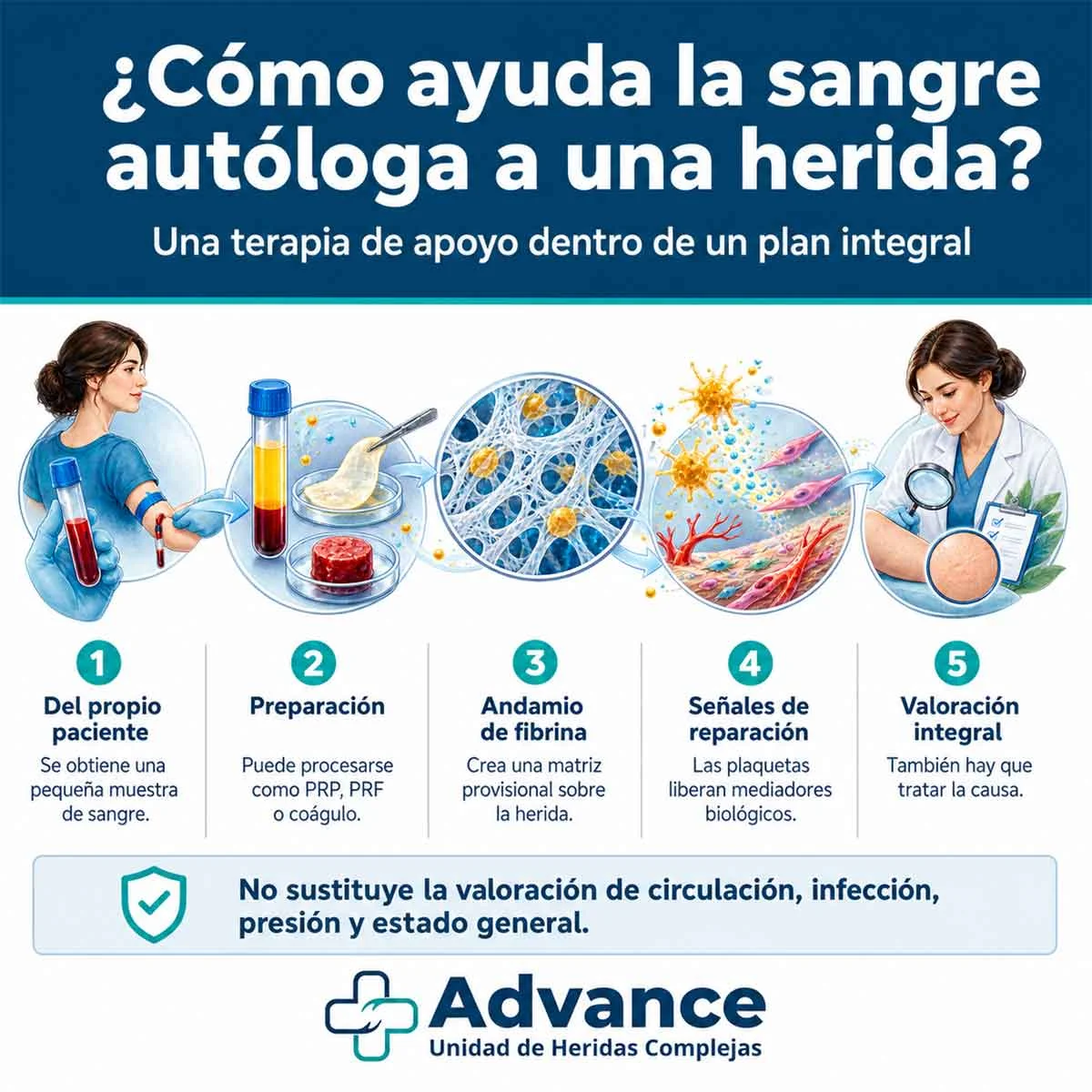 Infografía sobre cómo actúan el PRP, la fibrina y el coágulo autólogo en la cicatrización de heridas.