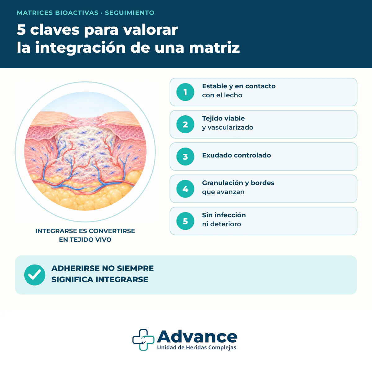 Infografía con cinco claves para valorar si una matriz bioactiva se integra bien en una herida.