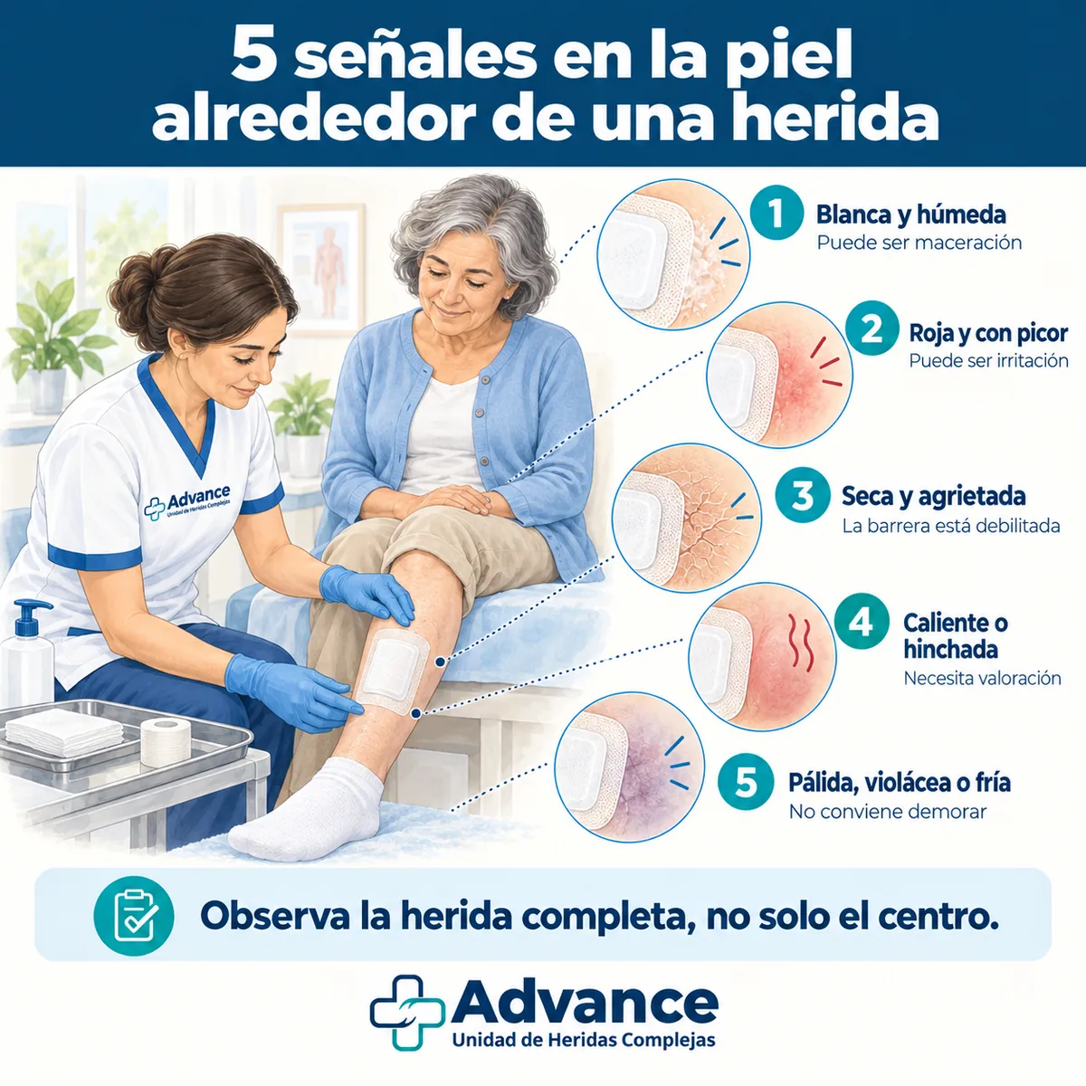 Infografía con cinco cambios de la piel perilesional: humedad, picor, grietas, calor y alteración del color.